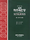 특발성척추측만증